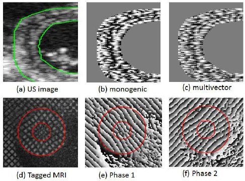 a-test-ultrasound-image-b-monogenic-phase-cos-ph-c.png