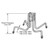 Dayton Brace Anchor, 3/4in Insert, 11in Slab, 0.375in Wire (35/Cs)