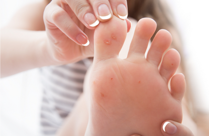 Blog - How Do I Take Care of My Feet If I Have to Stand Up Most of the Day?