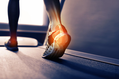 Blog - How Do Shoe Inserts Fight Foot Pain?