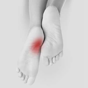 Close up of feet showing where pain from plantar fasciitis would be.