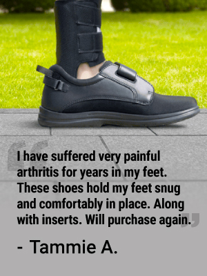 Arthritis Review