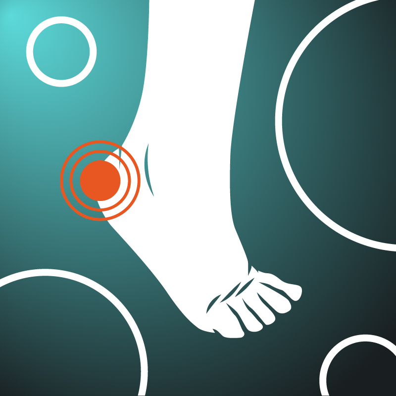 Heel Pain