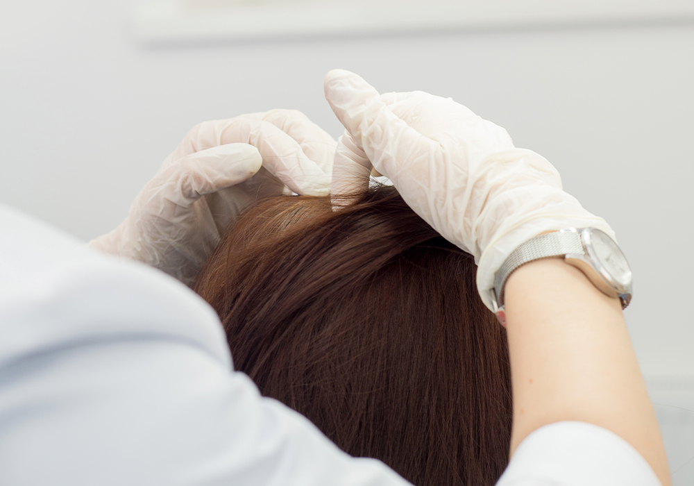 servicio análisis capilar 1