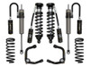 ICON 1996-2002 Toyota 4Runner 0-3" Lift Stage 4 Suspension System Tubular UCA - K53134