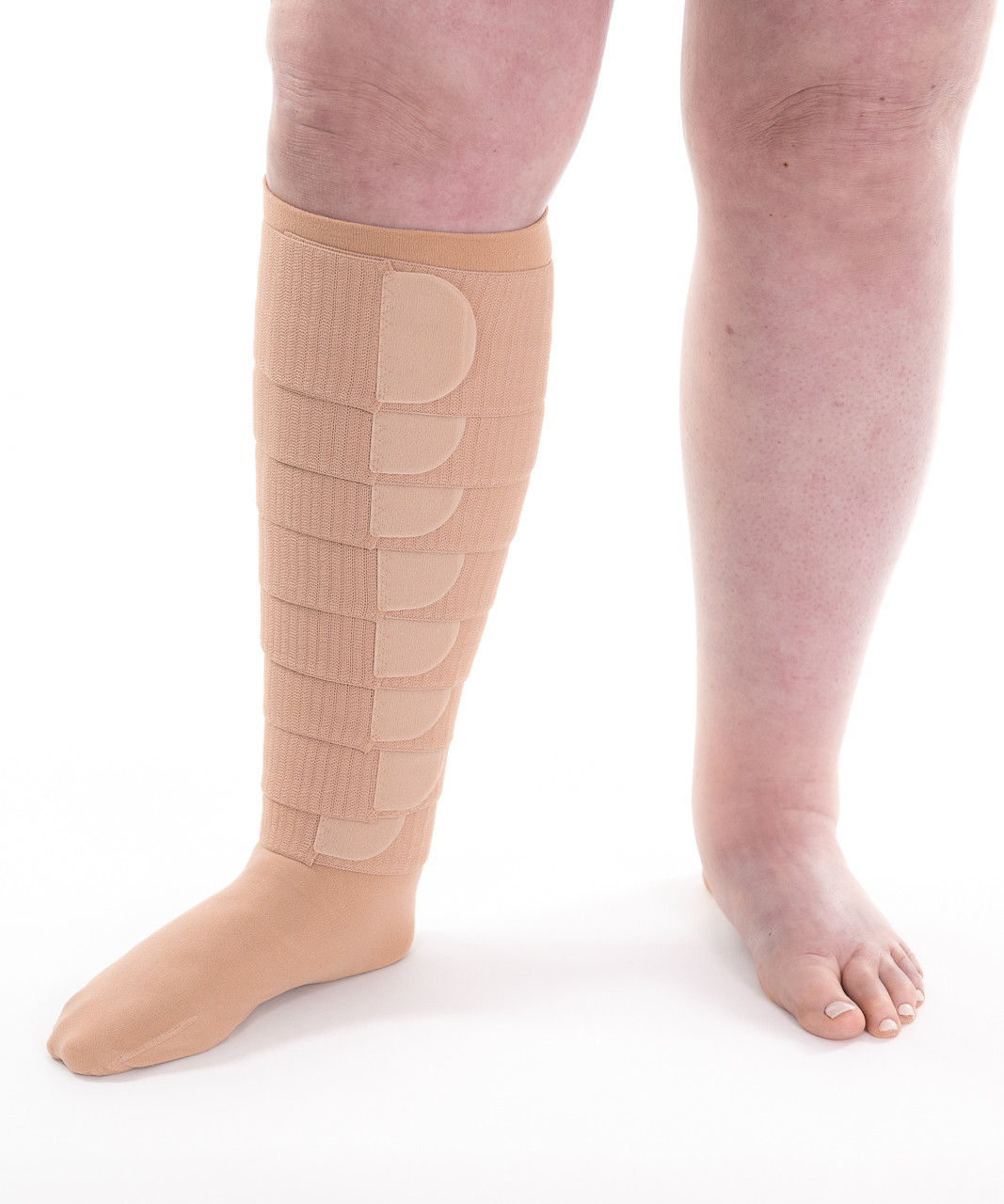 Compression Garments Can Ease Lymphedema. Covering Costs? Not So