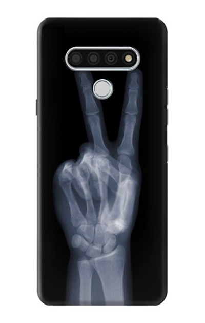 S3101 X-ray Peace Sign Fingers Case Cover Custodia per LG Stylo 6