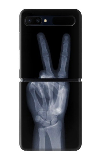 S3101 X-ray Peace Sign Fingers Case Cover Custodia per Samsung Galaxy Z Flip 5G