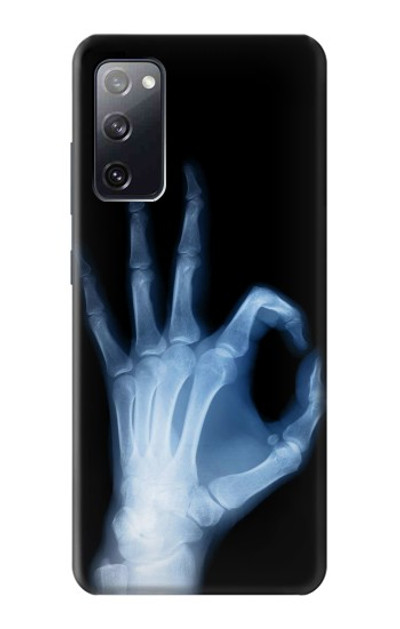 S3239 X-Ray Hand Sign OK Case Cover Custodia per Samsung Galaxy S20 FE