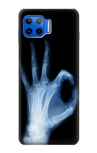 S3239 X-Ray Hand Sign OK Case Cover Custodia per Motorola Moto G 5G Plus