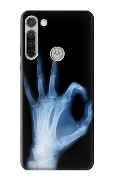 S3239 X-Ray Hand Sign OK Case Cover Custodia per Motorola Moto G8