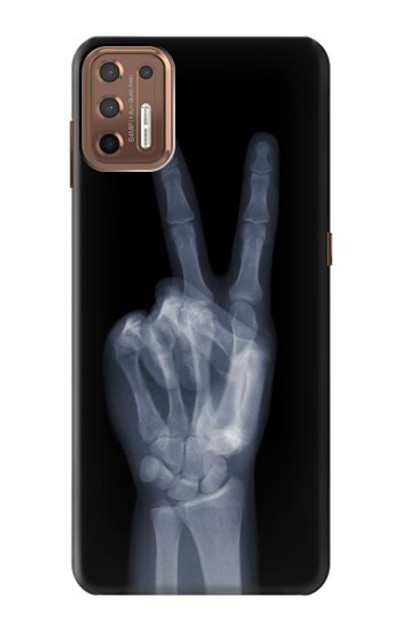 S3101 X-ray Peace Sign Fingers Case Cover Custodia per Motorola Moto G9 Plus