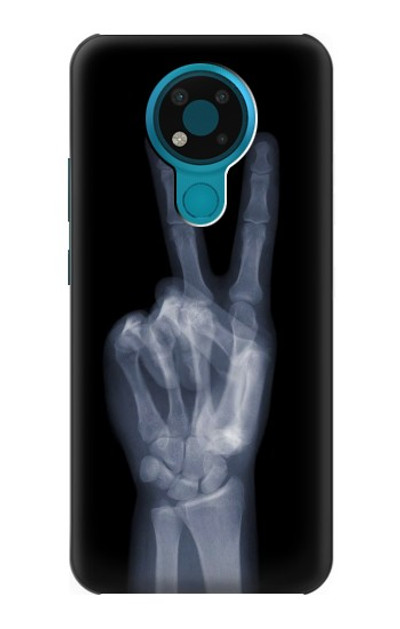 S3101 X-ray Peace Sign Fingers Case Cover Custodia per Nokia 3.4