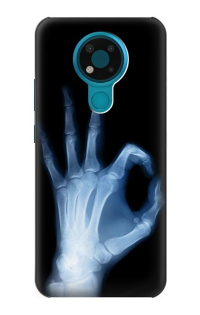 S3239 X-Ray Hand Sign OK Case Cover Custodia per Nokia 3.4