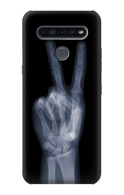 S3101 X-ray Peace Sign Fingers Case Cover Custodia per LG K41S