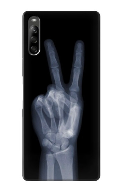 S3101 X-ray Peace Sign Fingers Case Cover Custodia per Sony Xperia L5