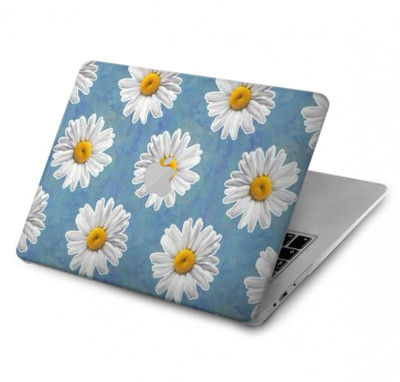 S3454 Floral Daisy Case Cover Custodia per MacBook 12″ - A1534