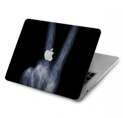 S3101 X-ray Peace Sign Fingers Case Cover Custodia per MacBook Air 13″ - A1369, A1466
