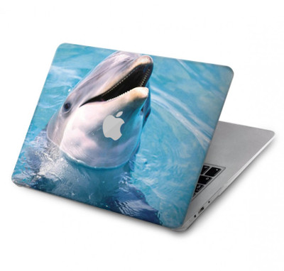 S1291 Dolphin Case Cover Custodia per MacBook Air 13″ - A1932, A2179, A2337