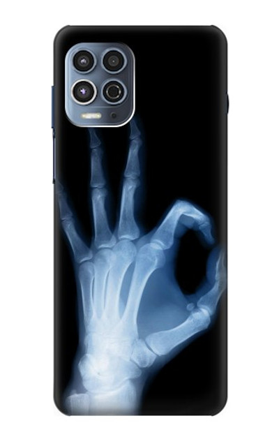 S3239 X-Ray Hand Sign OK Case Cover Custodia per Motorola Moto G100