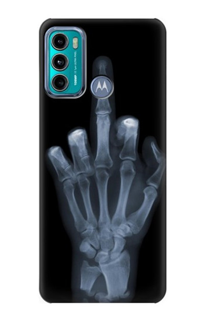 S1143 X-ray Hand Middle Finger Case Cover Custodia per Motorola Moto G60, G40 Fusion