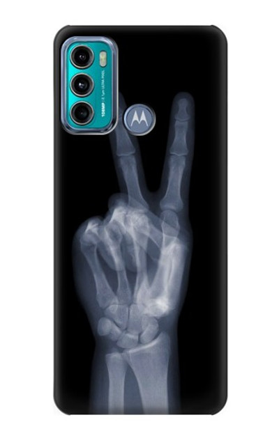 S3101 X-ray Peace Sign Fingers Case Cover Custodia per Motorola Moto G60, G40 Fusion