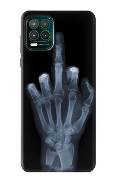 S1143 X-ray Hand Middle Finger Case Cover Custodia per Motorola Moto G Stylus 5G