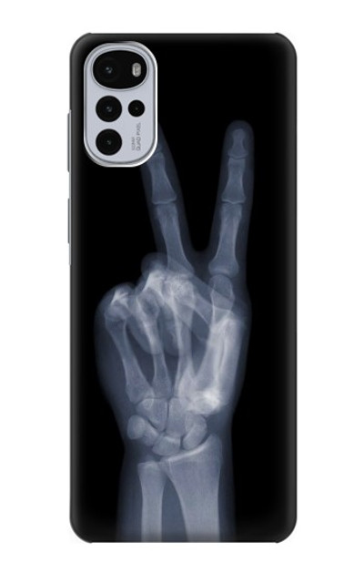 S3101 X-ray Peace Sign Fingers Case Cover Custodia per Motorola Moto G22