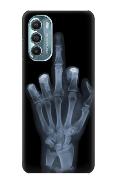 S1143 X-ray Hand Middle Finger Case Cover Custodia per Motorola Moto G Stylus 5G (2022)