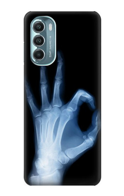 S3239 X-Ray Hand Sign OK Case Cover Custodia per Motorola Moto G Stylus 5G (2022)