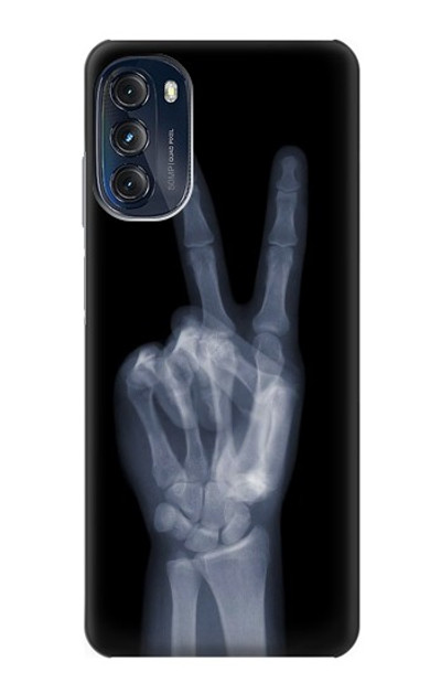 S3101 X-ray Peace Sign Fingers Case Cover Custodia per Motorola Moto G (2022)