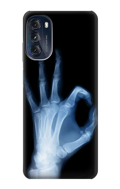 S3239 X-Ray Hand Sign OK Case Cover Custodia per Motorola Moto G (2022)