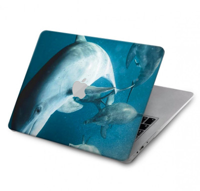 S3878 Dolphin Case Cover Custodia per MacBook Pro 16 M1,M2 (2021,2023) - A2485, A2780