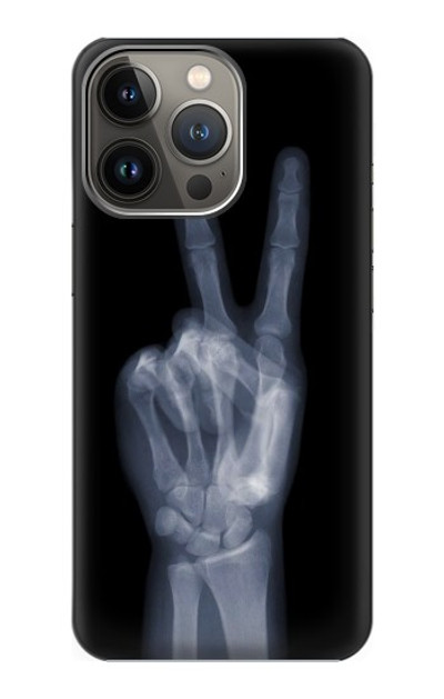 S3101 X-ray Peace Sign Fingers Case Cover Custodia per iPhone 14 Pro Max