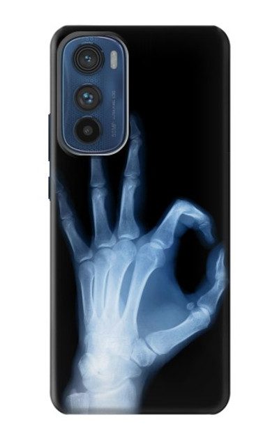 S3239 X-Ray Hand Sign OK Case Cover Custodia per Motorola Edge 30