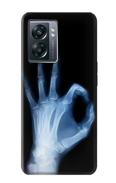 S3239 X-Ray Hand Sign OK Case Cover Custodia per OnePlus Nord N300