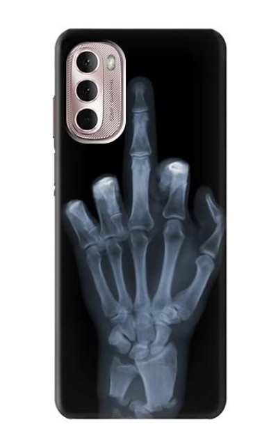 S1143 X-ray Hand Middle Finger Case Cover Custodia per Motorola Moto G Stylus 4G (2022)