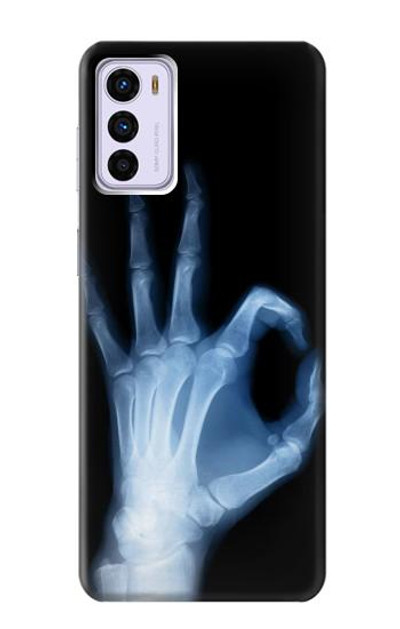 S3239 X-Ray Hand Sign OK Case Cover Custodia per Motorola Moto G42