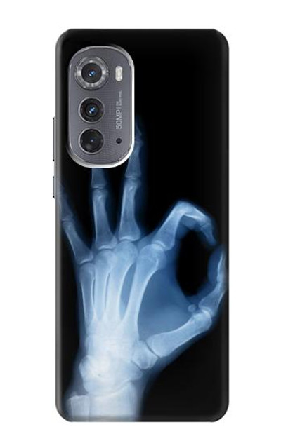 S3239 X-Ray Hand Sign OK Case Cover Custodia per Motorola Edge (2022)