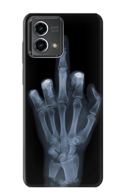 S1143 X-ray Hand Middle Finger Case Cover Custodia per Motorola Moto G Stylus 5G (2023)