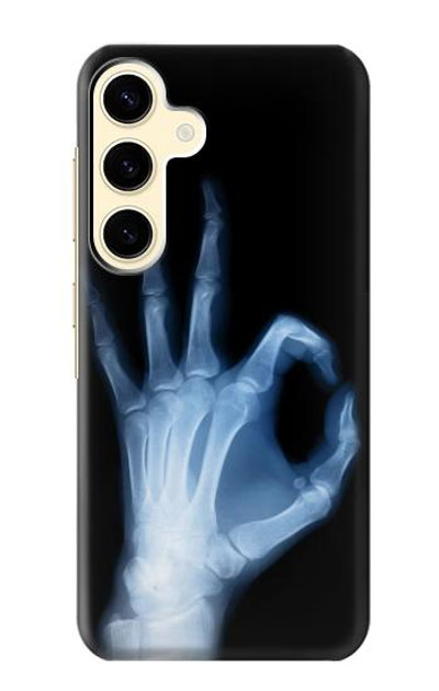 S3239 X-Ray Hand Sign OK Case Cover Custodia per Samsung Galaxy S24