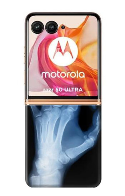 S3239 X-Ray Hand Sign OK Case Cover Custodia per Motorola Razr 50 Ultra