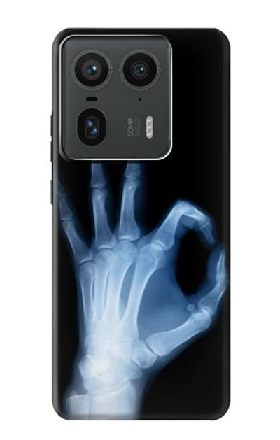 S3239 X-Ray Hand Sign OK Case Cover Custodia per Motorola Edge 50 Ultra