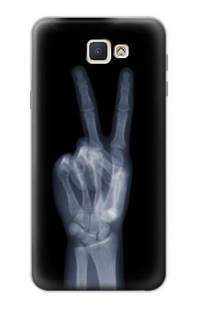 S3101 X-ray Peace Sign Fingers Case Cover Custodia per Samsung Galaxy J7 Prime (SM-G610F)