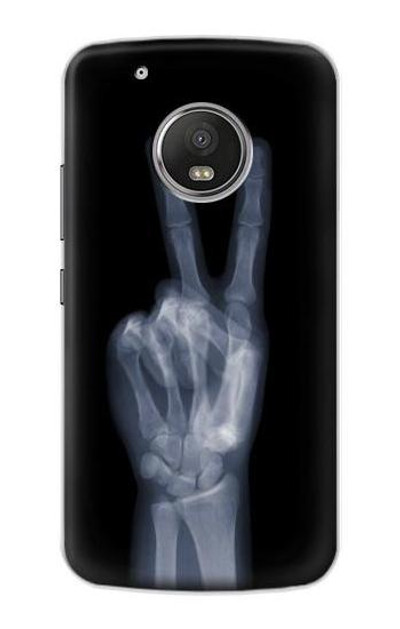 S3101 X-ray Peace Sign Fingers Case Cover Custodia per Motorola Moto G5 Plus