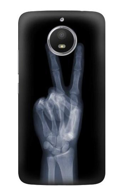 S3101 X-ray Peace Sign Fingers Case Cover Custodia per Motorola Moto E4 Plus