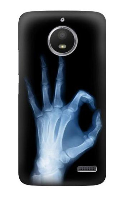 S3239 X-Ray Hand Sign OK Case Cover Custodia per Motorola Moto E4
