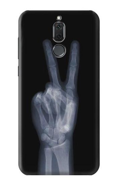 S3101 X-ray Peace Sign Fingers Case Cover Custodia per Huawei Mate 10 Lite