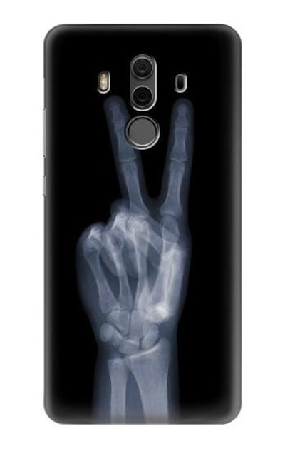 S3101 X-ray Peace Sign Fingers Case Cover Custodia per Huawei Mate 10 Pro, Porsche Design