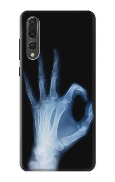 S3239 X-Ray Hand Sign OK Case Cover Custodia per Huawei P20 Pro